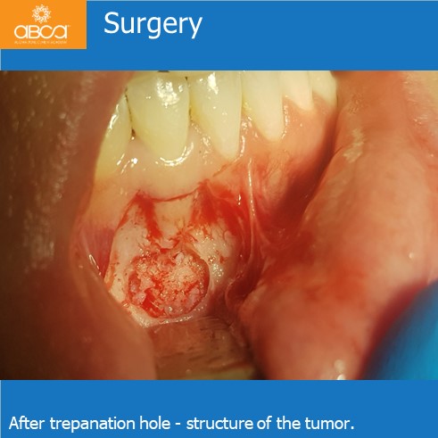 Clinical Case