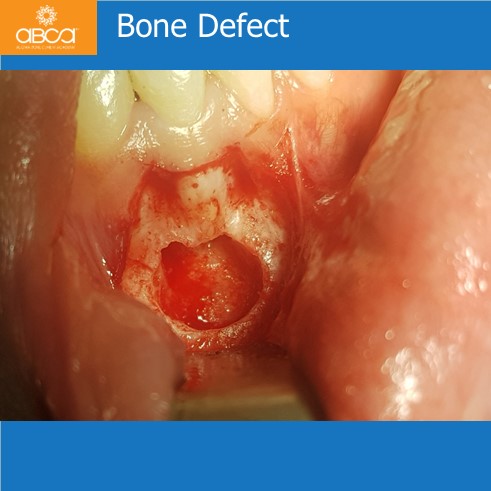 Clinical Case