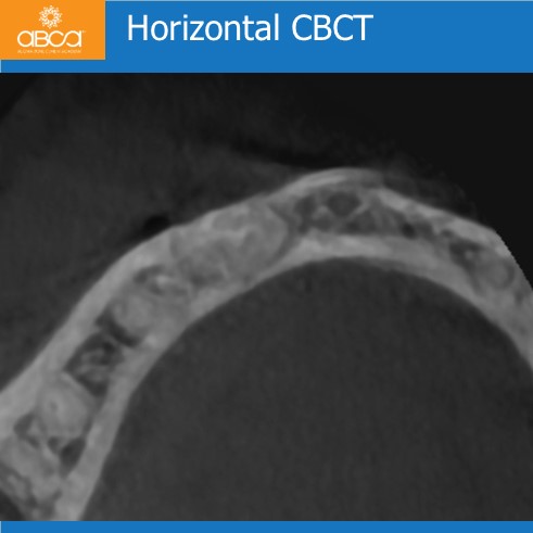 Clinical Case