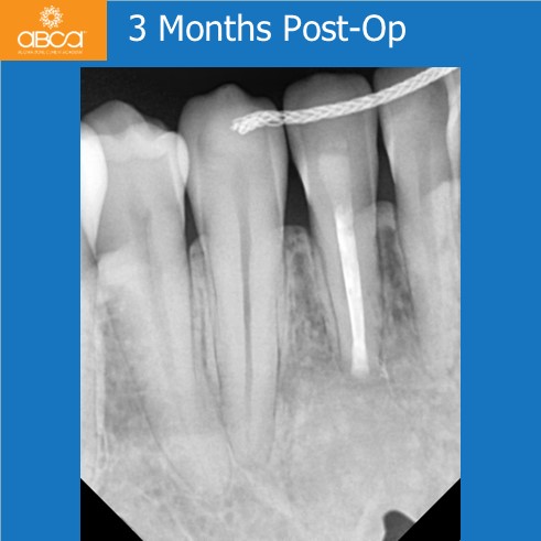 Clinical Case