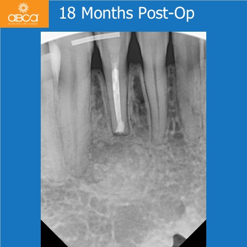 Clinical Case