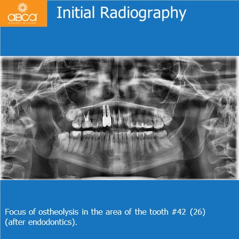 Clinical Case