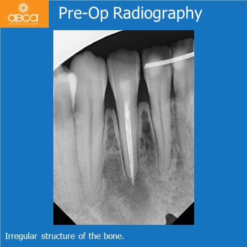 Clinical Case