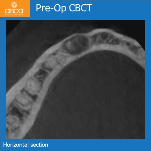 Clinical Case