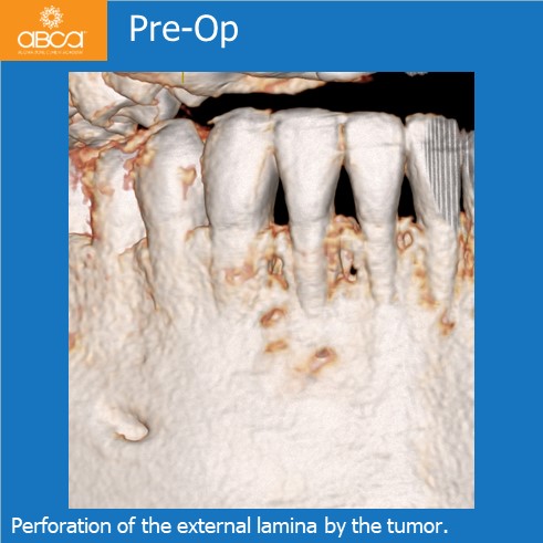 Clinical Case