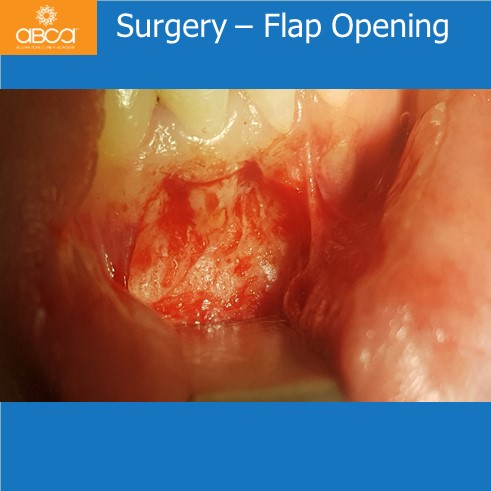 Clinical Case