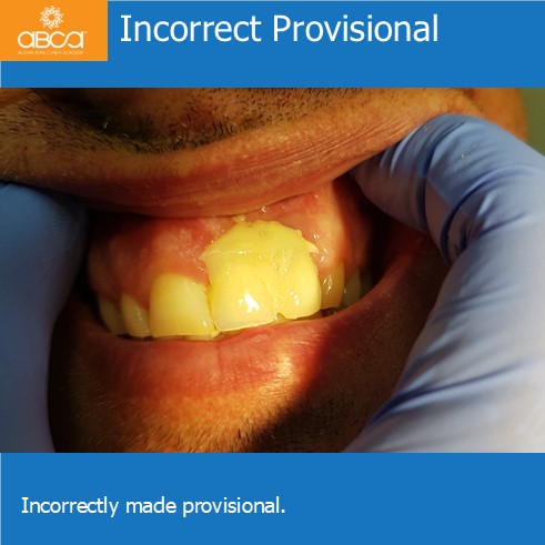 Clinical Case