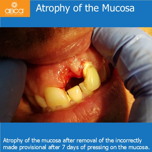 Clinical Case