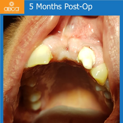 Clinical Case