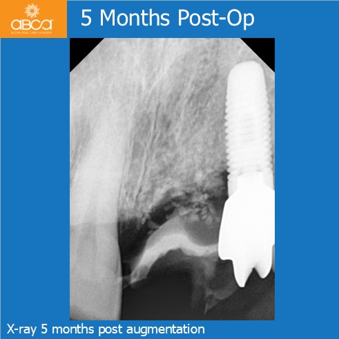 Clinical Case