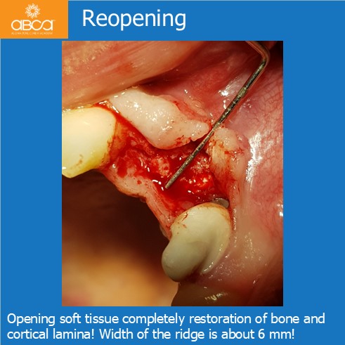 Clinical Case