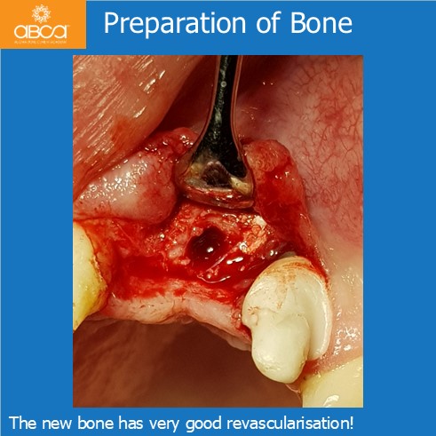 Clinical Case