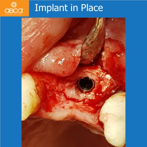 Clinical Case