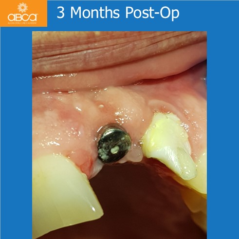 Clinical Case