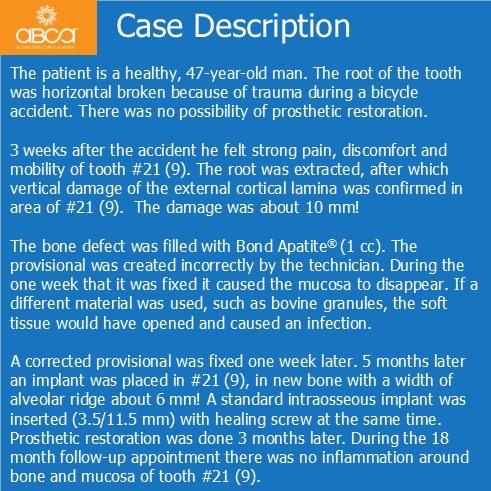 Clinical Case