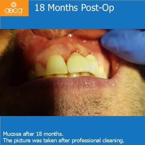 Clinical Case