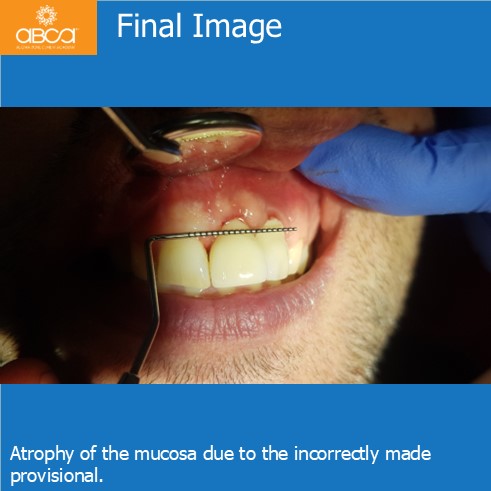 Clinical Case