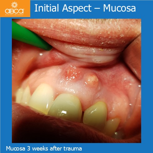 Clinical Case
