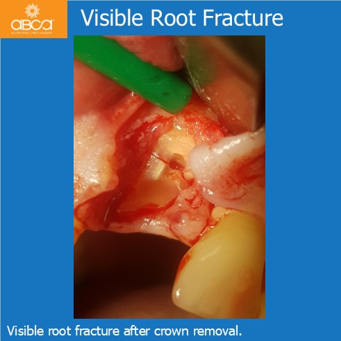 Clinical Case