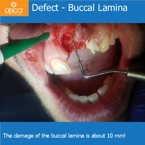Clinical Case