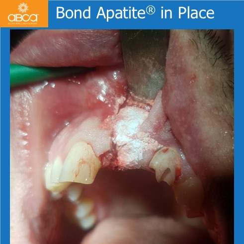Clinical Case