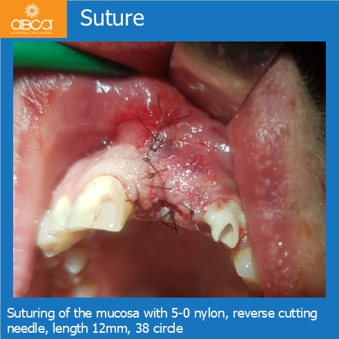 Clinical Case