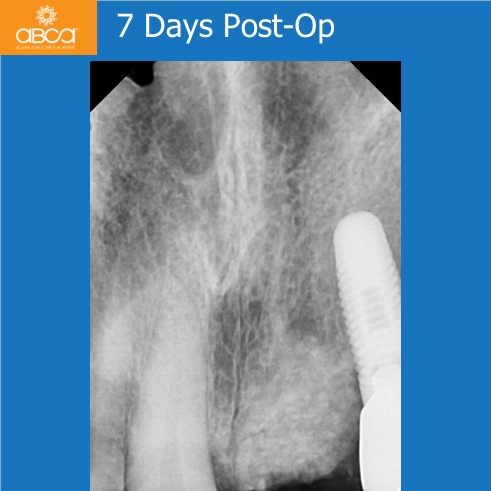Clinical Case