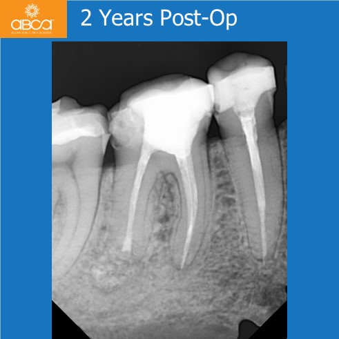 Clinical Case