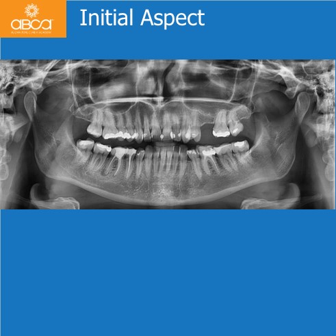 Clinical Case