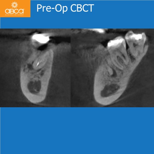 Clinical Case