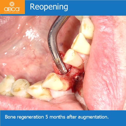 Clinical Case