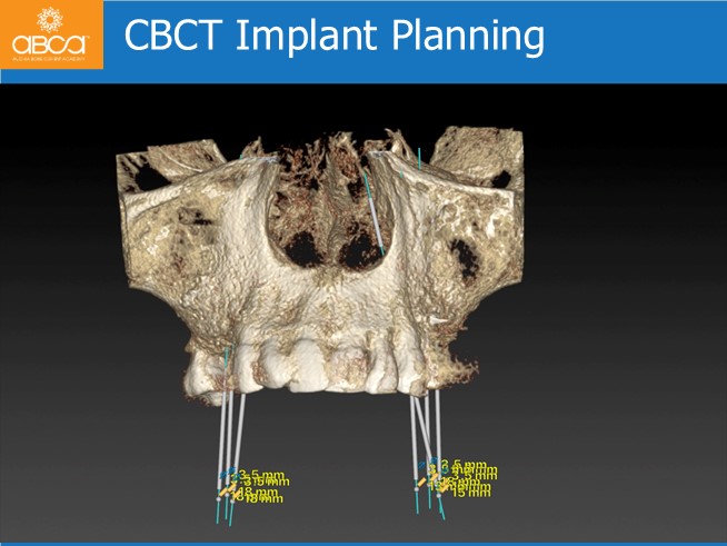 Clinical Case