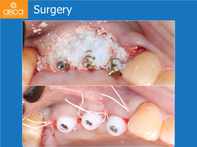Clinical Case