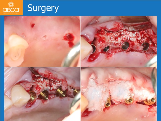 Clinical Case