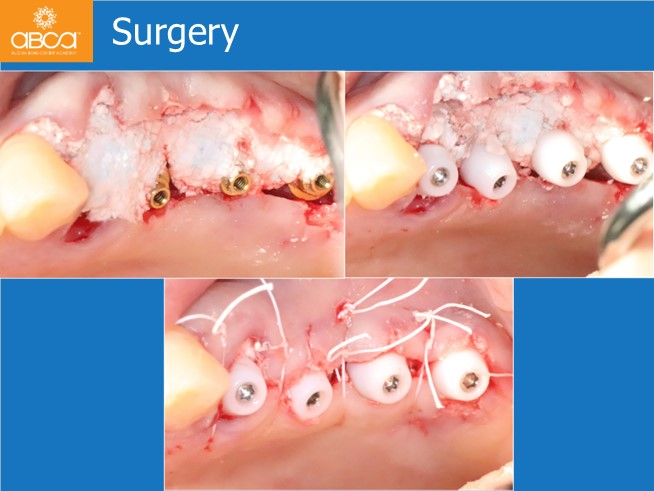 Clinical Case