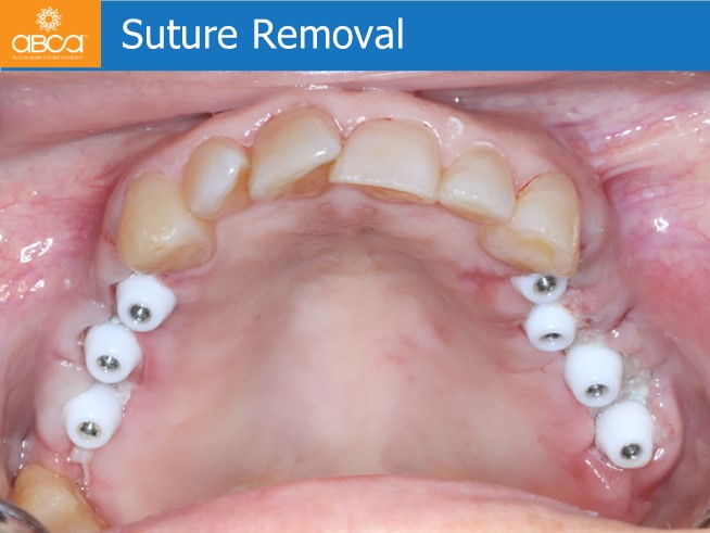 Clinical Case