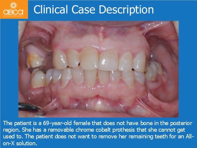Clinical Case