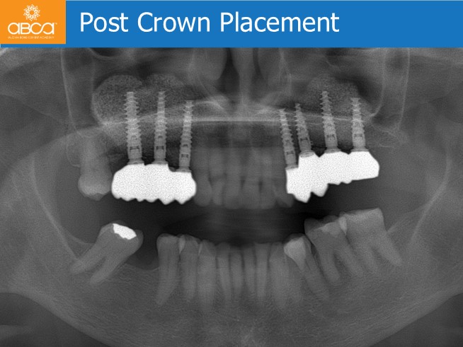 Clinical Case