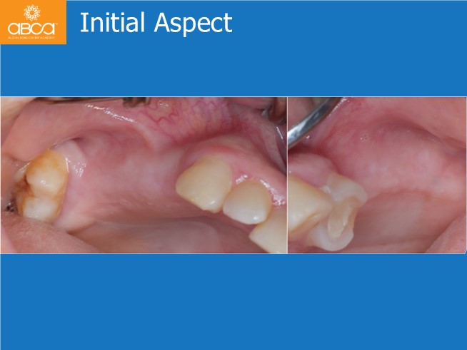 Clinical Case