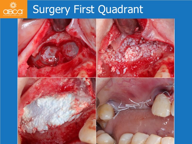 Clinical Case