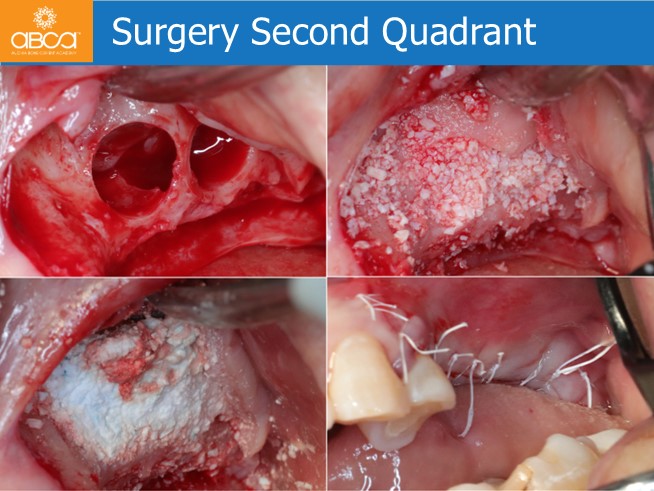 Clinical Case