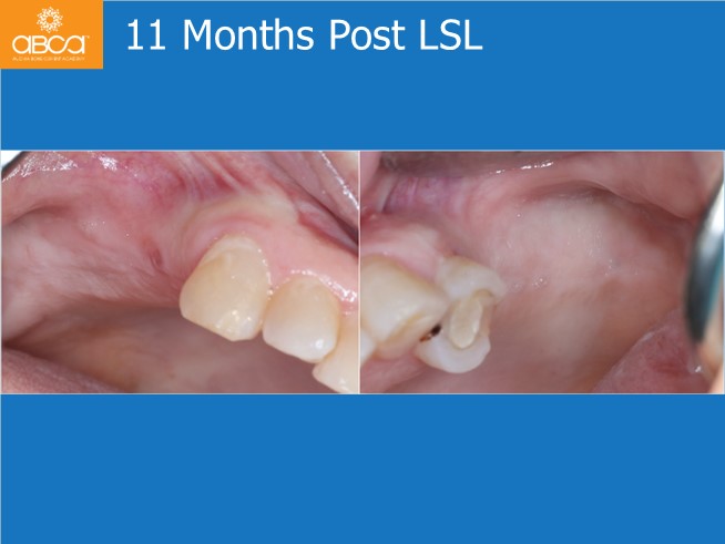 Clinical Case