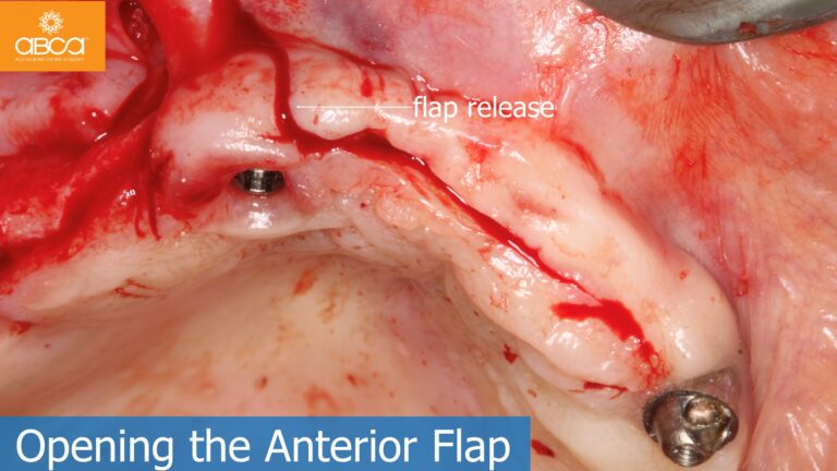 Clinical Case