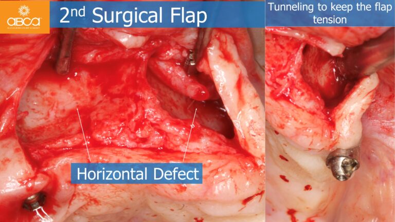Clinical Case