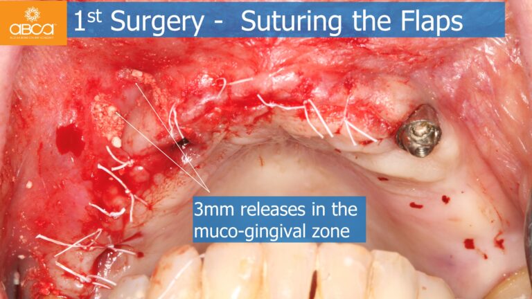 Clinical Case