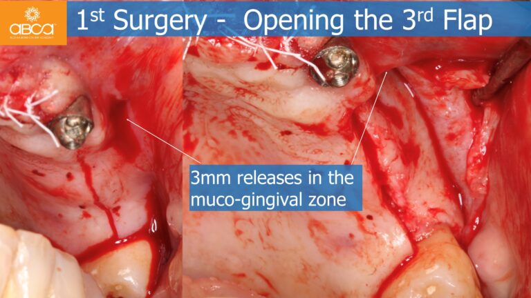 Clinical Case