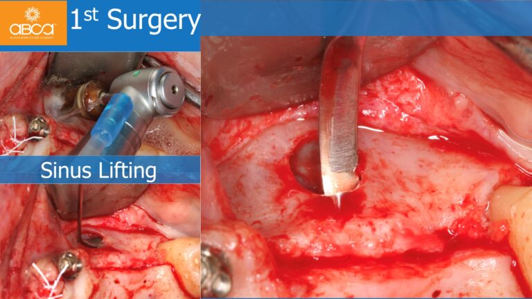 Clinical Case