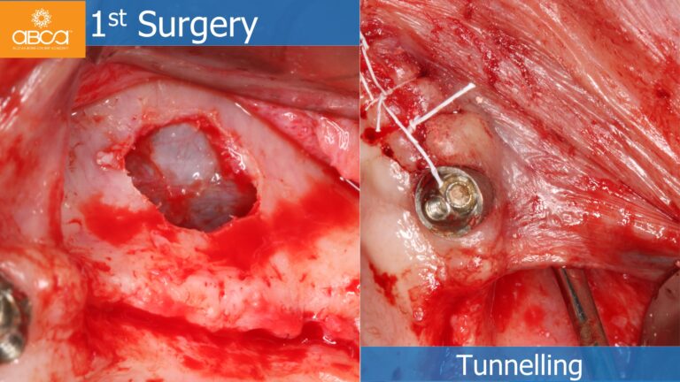 Clinical Case