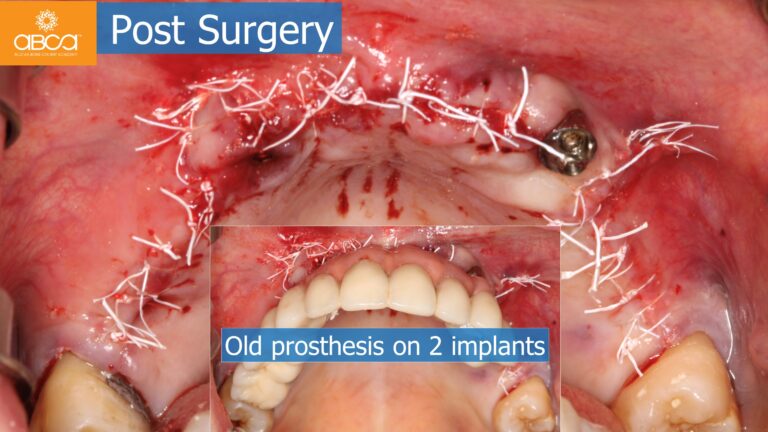 Clinical Case