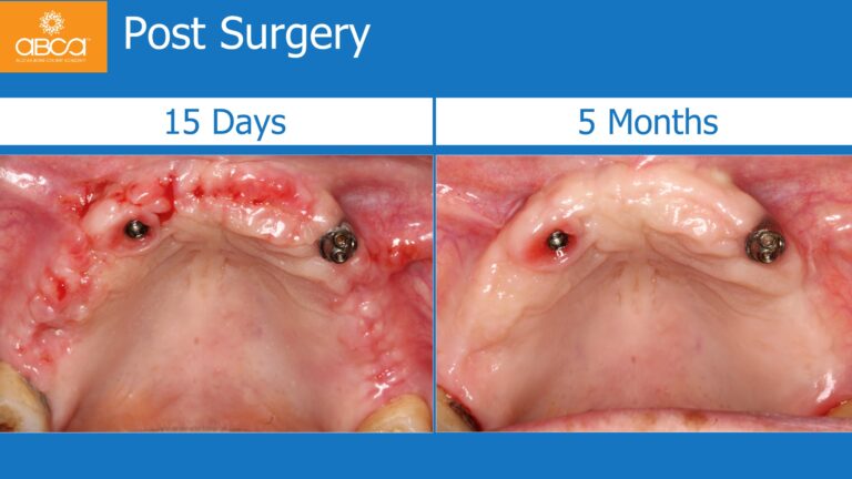 Clinical Case